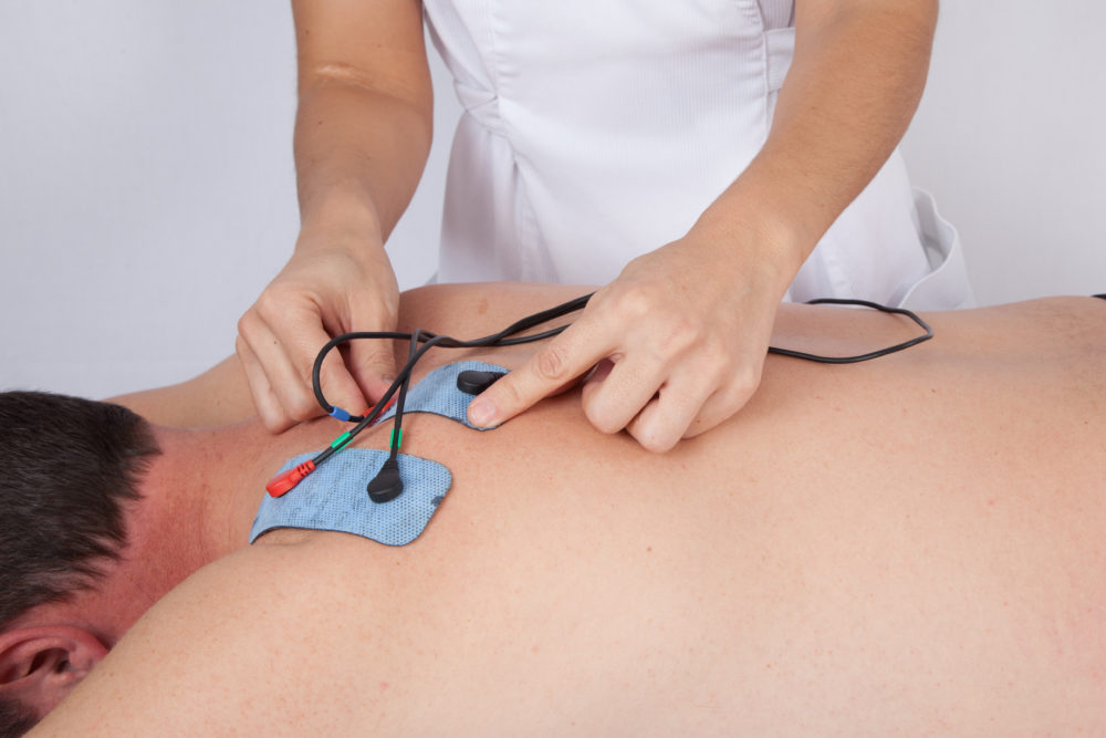functional electrical stimulation FES Propel Physiotherapy Toronto