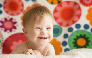 Gross Motor Milestones for Children with Down Syndrome Propel Physiotherapy Pediatric Physiotherapy Etobicoke