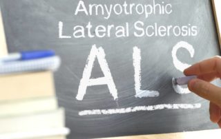 Physiotherapy Treatment for ALS Symptoms Propel Physiotherapy Etobicoke Physiotherapy Pickering