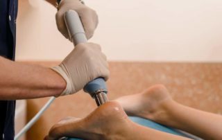 shockwave therapy for plantar fasciitis Propel Physiotherapy