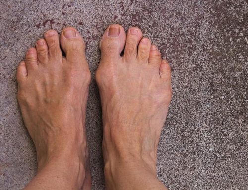 What Conditions Are Orthotics Used to Treat?
