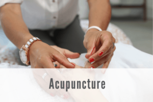 acupuncture Propel Physiotherapy 