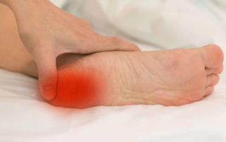 plantar fasciitis pain management Propel Physiotherapy