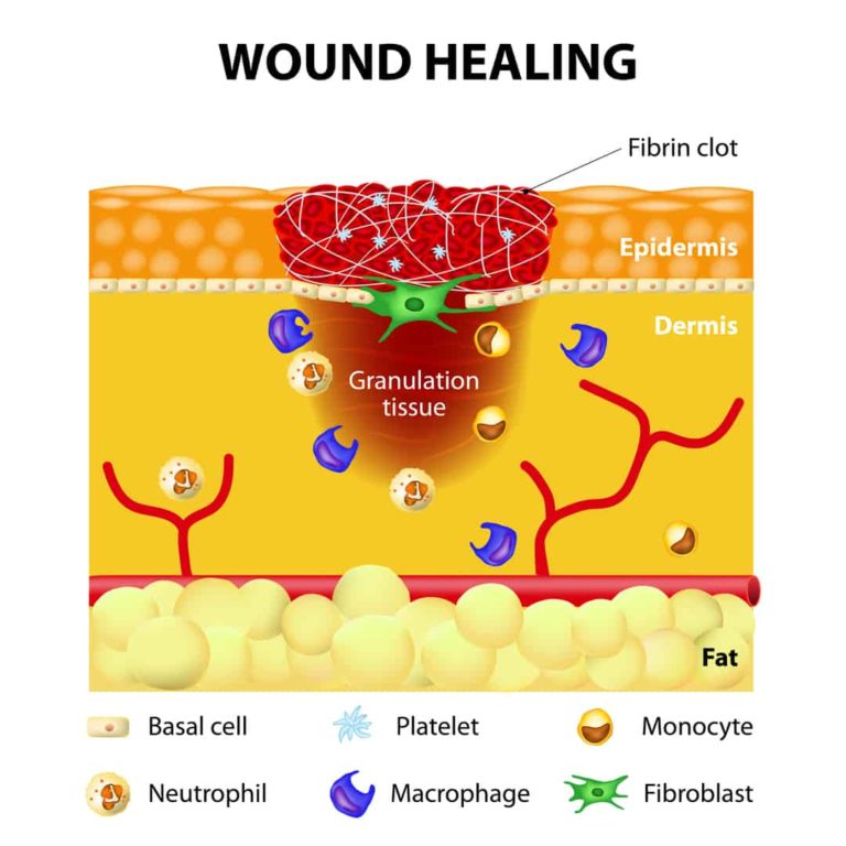 Acupuncture for Scar Tissue Treatment Propel Physiotherapy
