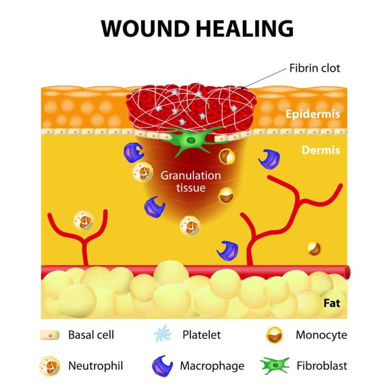 Acupuncture for Scar Tissue Treatment Propel Physiotherapy