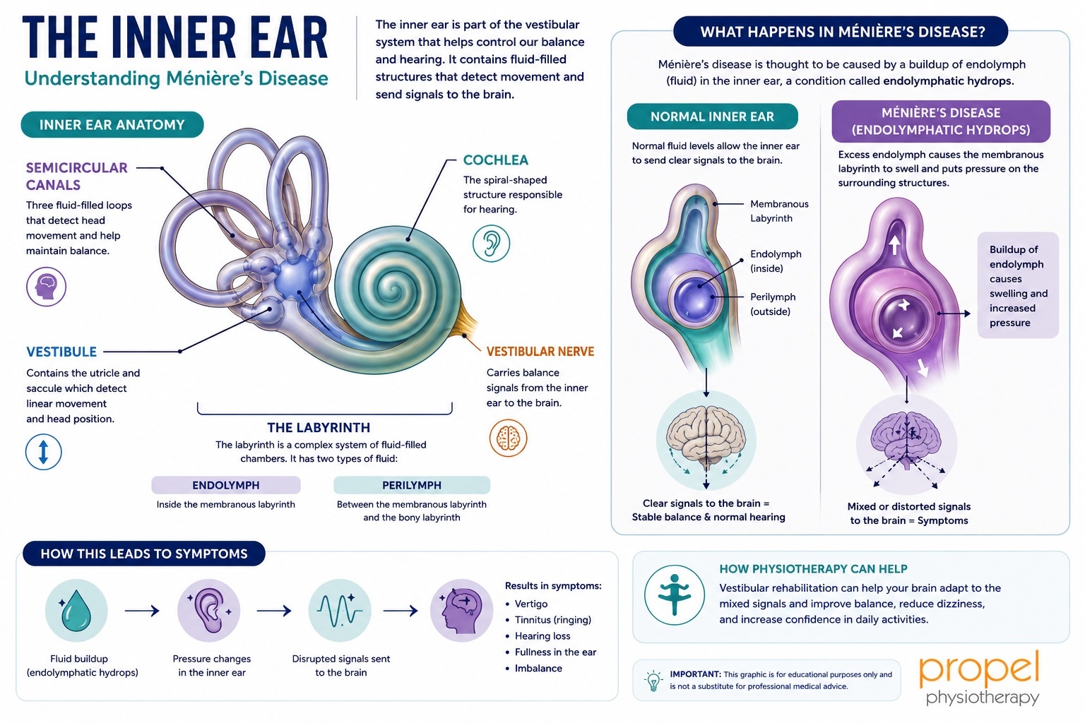 Inner ear diagram showing how Meniere's disease and symptoms impact your health. Propel Physiotherapy.
