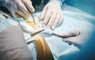 laminectomy post surgical care Propel Physiotherapy