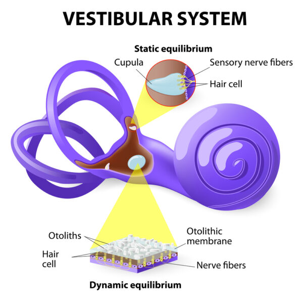 Vestibular Neuritis Symptoms, Causes & Physical Therapy Management