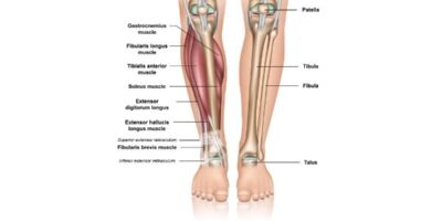 Shin Splints Physiotherapy Propel Physiotherapy