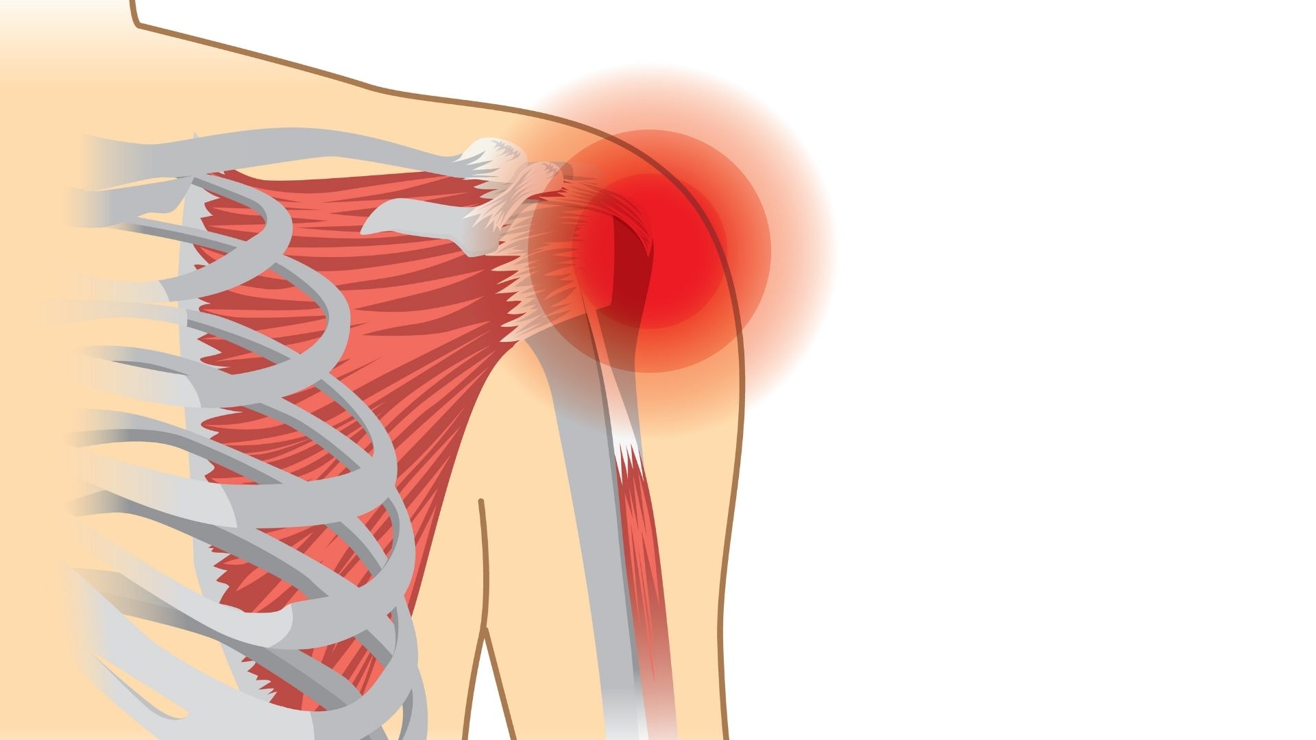 Shoulder Pain Caused By The Rotator Cuff - Mobile Massage & Personal  Training