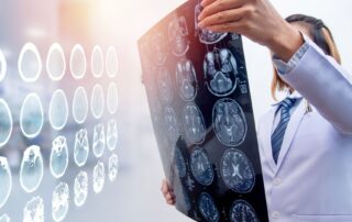 The effects of brain injury: how location impacts outcomes. Propel Physiotherapy.