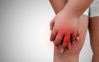 Inflamed joints. Juvenile idiopathic arthritis treatment - Propel Physiotherapy.