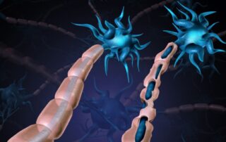Peripheral nerve injury treatment Propel Physiotherapy