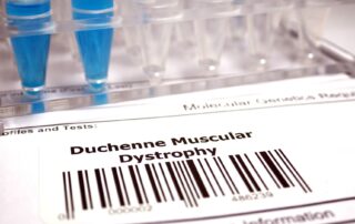 Duchenne muscular dystrophy treatment Propel Physiotherapy