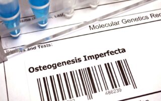 osteogenesis imperfecta diagnosis osteogenesis imperfecta treatment Propel Physiotherapy