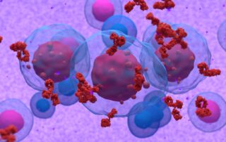Blood plasma with multiple myeloma. Multiple myeloma treatment Propel Physiotherapy.