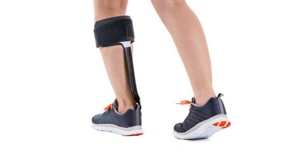 Ankle-foot orthosis or foot up. Choosing the right walking aid by Propel Physiotherapy. 