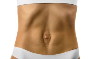 Diastasis recti physiotherapy Propel Physiotherapy.