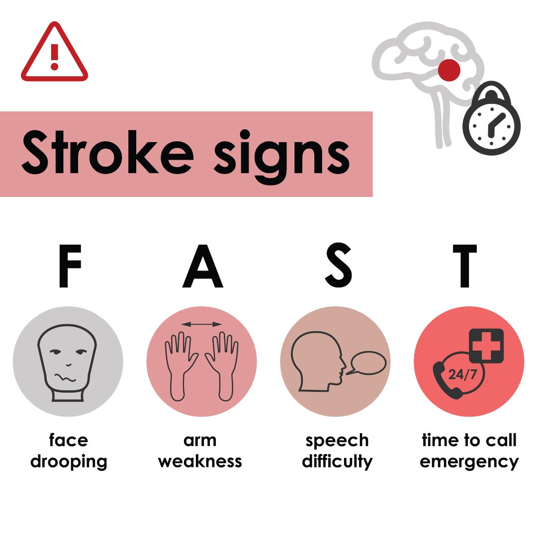 FAST signs of stroke. Propel Physiotherapy stroke rehabilitation.