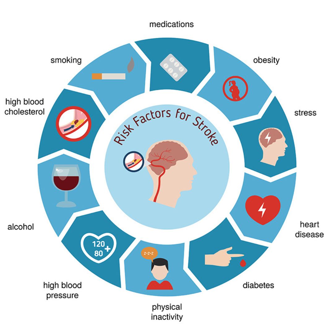 Risk factors for stroke. Signs of stroke in young people. Propel Physiotherapy stroke physiotherapy.