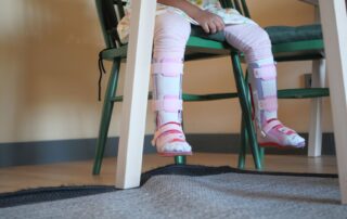 Idiopathic toe walking treatment Propel Physiotherapy