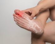 Man seated crossing his right leg over the left showing the bottom of his right foot in pain. Physiotherapy for stress fractures in runners. Propel Physiotherapy - Etobicoke | Pickering | Peterborough.