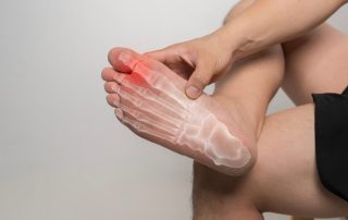 Man seated crossing his right leg over the left showing the bottom of his right foot in pain. Physiotherapy for stress fractures in runners. Propel Physiotherapy - Etobicoke | Pickering | Peterborough.